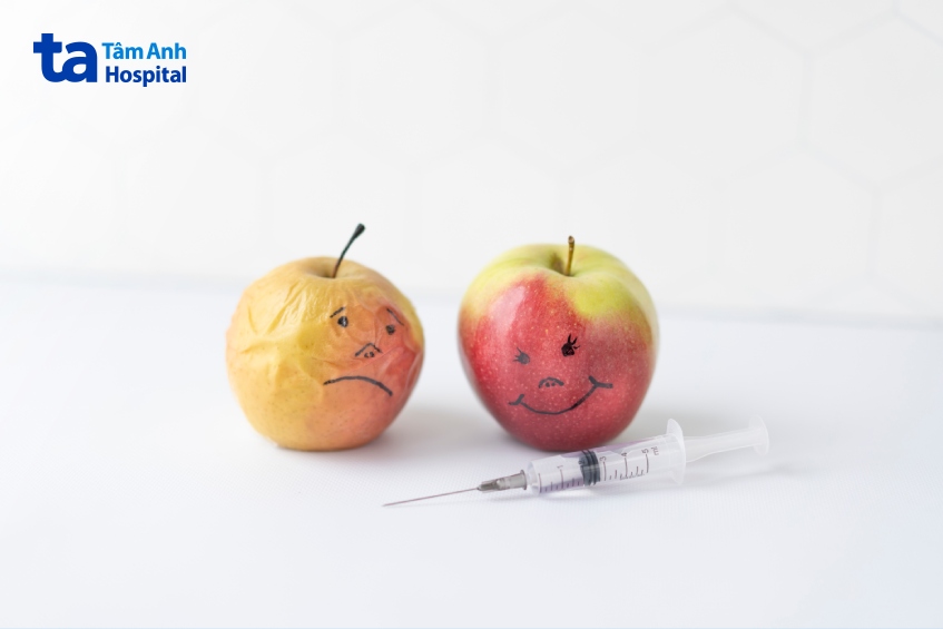 tiêm filler bao lâu thì ổn định