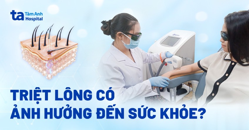 Triệt lông có hại không? 7 tác hại tiềm ẩn ảnh hưởng đến sức khỏe