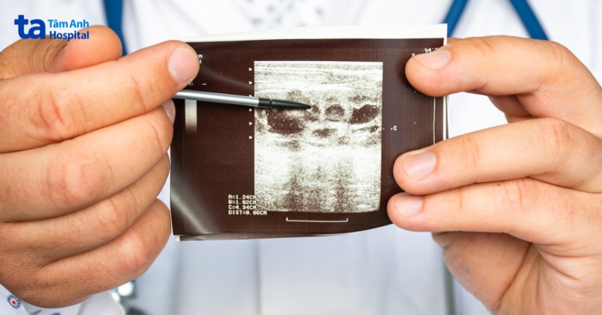 tùy tình trạng bệnh bác sĩ sẽ chỉ định lượng nước cụ thể