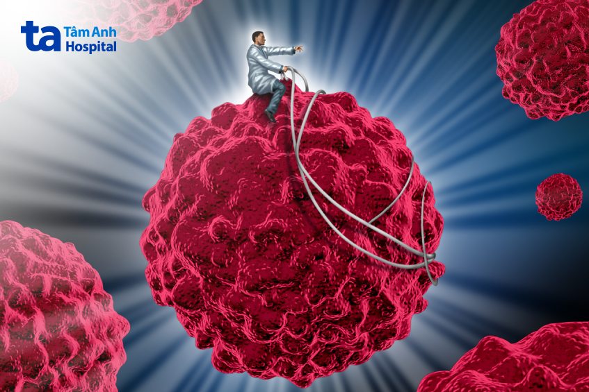 ung thư vú di căn vào gan