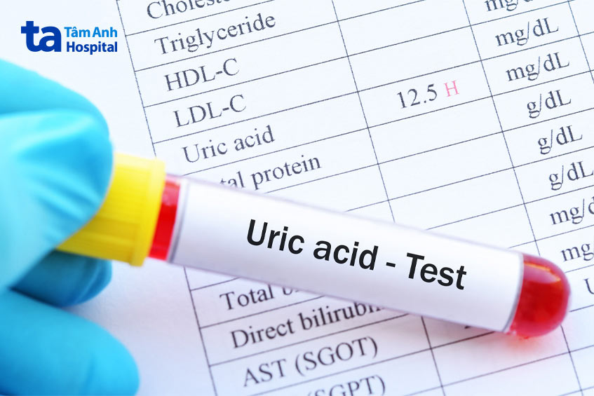 Uống thuốc hạ acid uric máu khi có triệu chứng gout