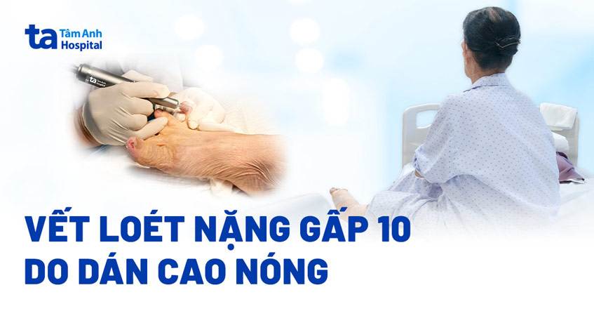 Vết loét nặng gấp 10 lần sau một đêm dán cao nóng lên vết thương