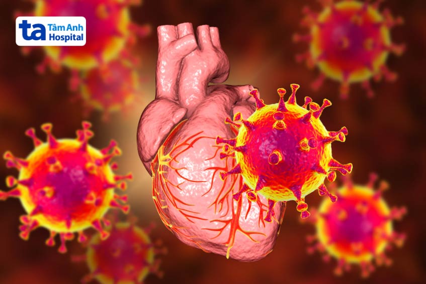Nguyên nhân hình thành viêm cơ tim có liên quan đến nhiễm khuẩn, virus