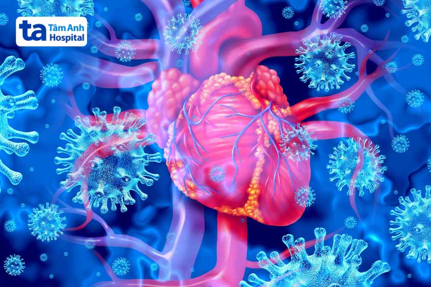 Nguyên nhân gây viêm cơ tim ở trẻ em thường gặp là do virus