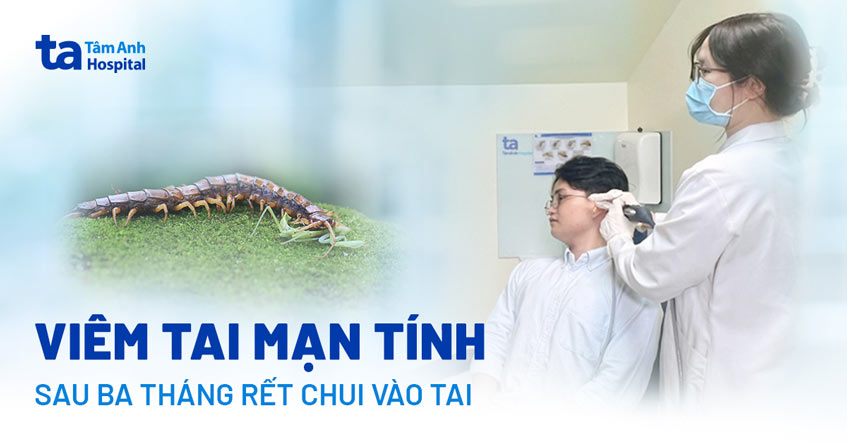 Viêm tai mạn tính sau 3 tháng rết chui vào tai