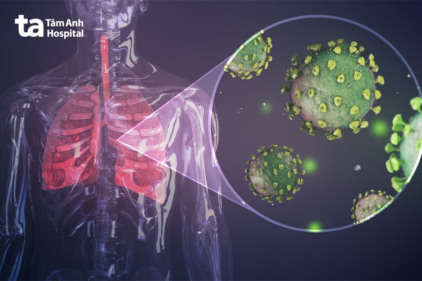Virus gây viêm phổi cấp dễ dàng lây truyền trong cộng đồng