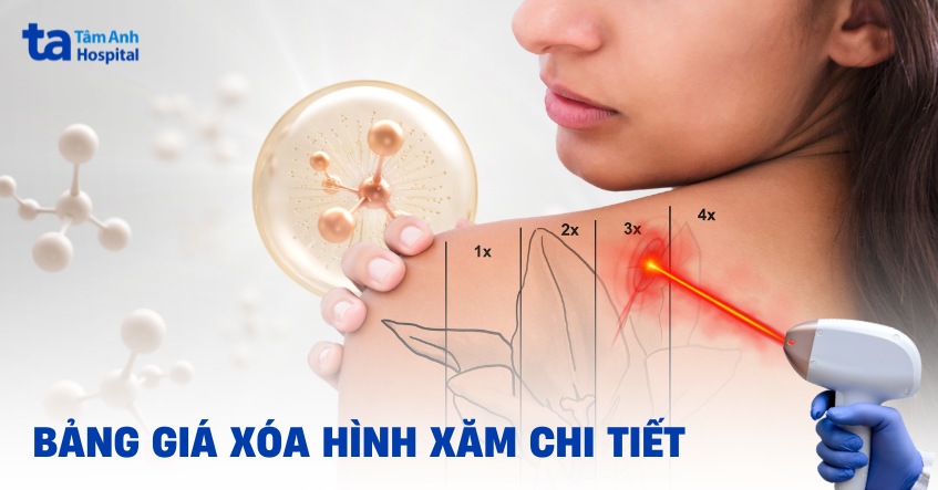 Chi phí xóa hình xăm bao nhiêu tiền? Bảng giá vị trí, kích thước