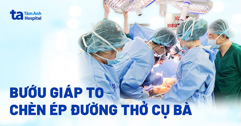 30 năm phớt lờ bướu giáp, cụ bà nguy cơ ngạt thở