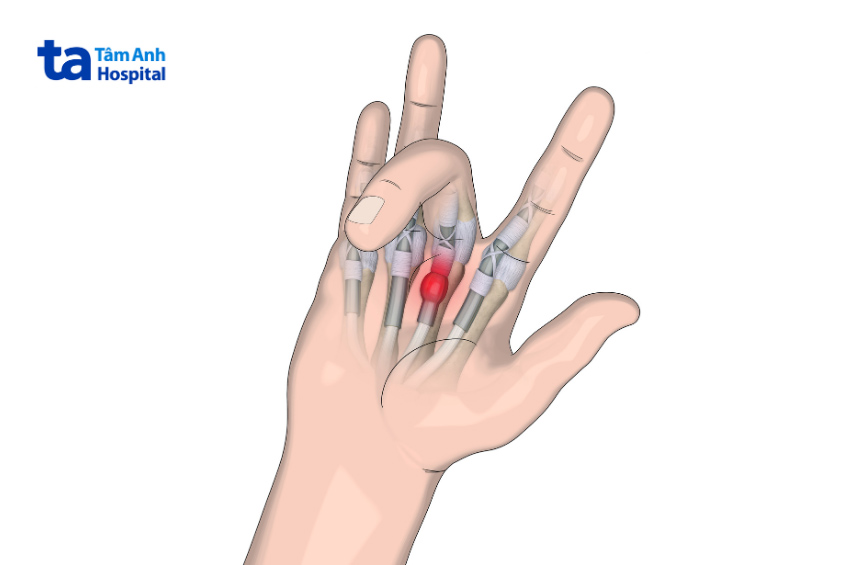 bài tập cải thiện sức mạnh và độ linh hoạt