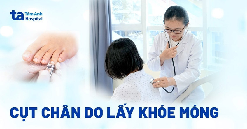 Bệnh nhân bị cắt cụt chân do lấy khóe móng