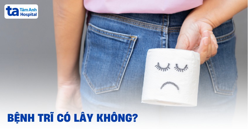 Bệnh trĩ có lây không? Lây qua đường nào? [Bác sĩ giải đáp]