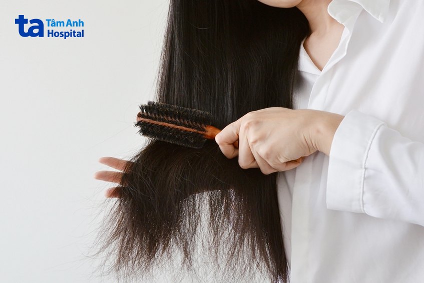 Bệnh tuyến giáp khiến tóc mất đi độ ẩm tự nhiên
