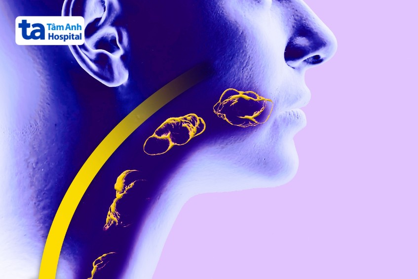 bị rối loạn vận động thực quản