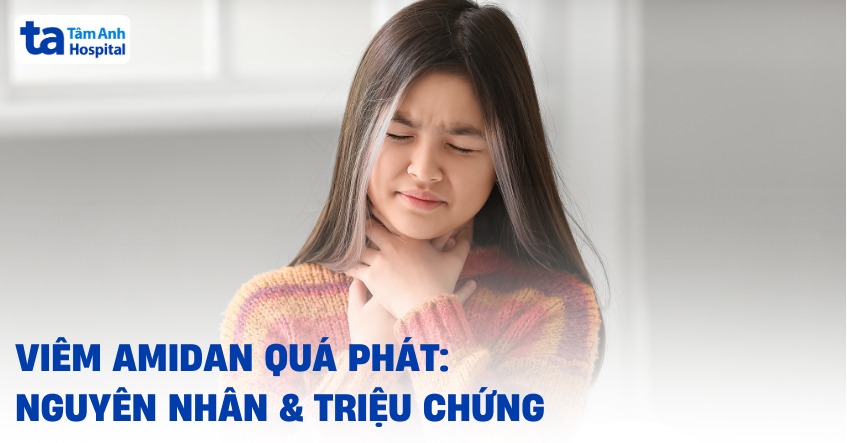 Viêm amidan quá phát: Nguyên nhân, triệu chứng và cách phòng ngừa