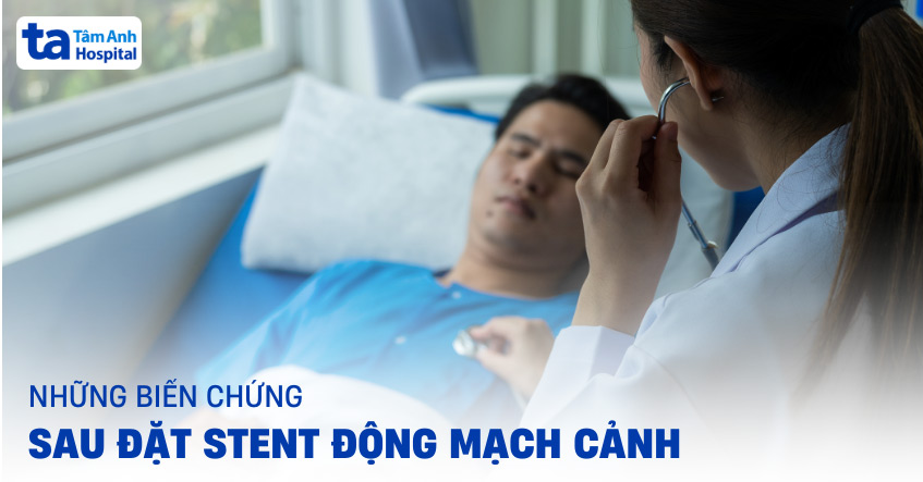 12 biến chứng sau đặt stent động mạch cảnh: Làm sao giảm rủi ro?