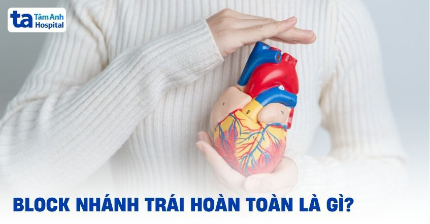 Block nhánh trái hoàn toàn là gì? Tiêu chuẩn chẩn đoán và điều trị