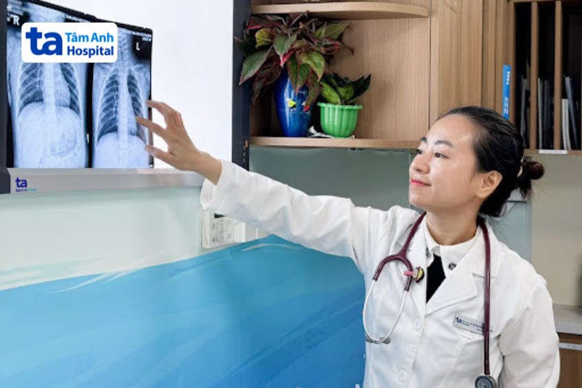 BS CKI Nguyễn Thị Kim Anh kiểm tra phim bệnh nhi viêm phổi