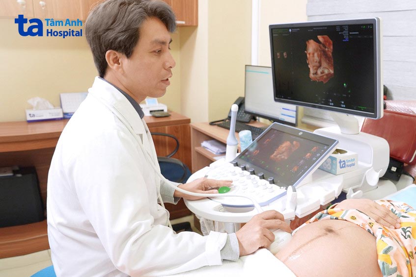 bs tú siêu âm doppler cho thai phụ
