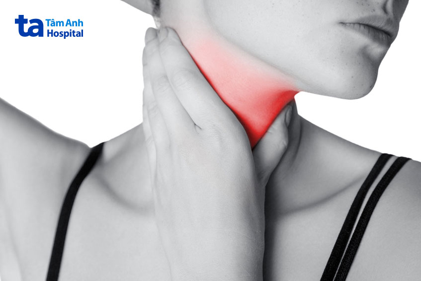 các triệu chứng điển hình như đau họng kéo dài