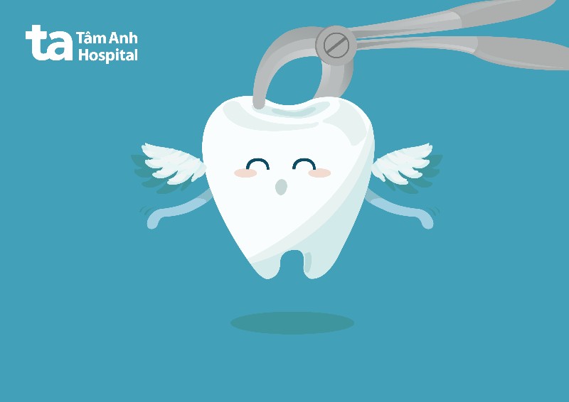 Chi phí nhổ răng không đau là bao nhiêu?