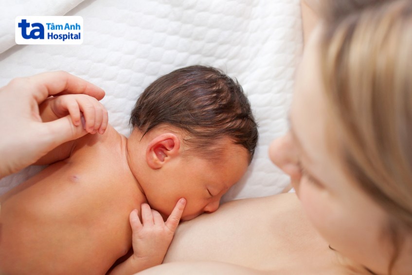 cải thiện tình trạng vàng da sinh lý ở trẻ sơ sinh