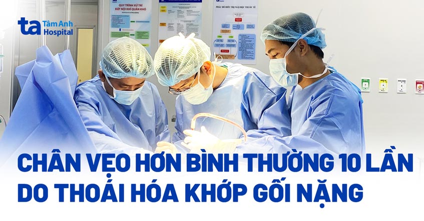 chân vẹo hơn bình thường 10 lần