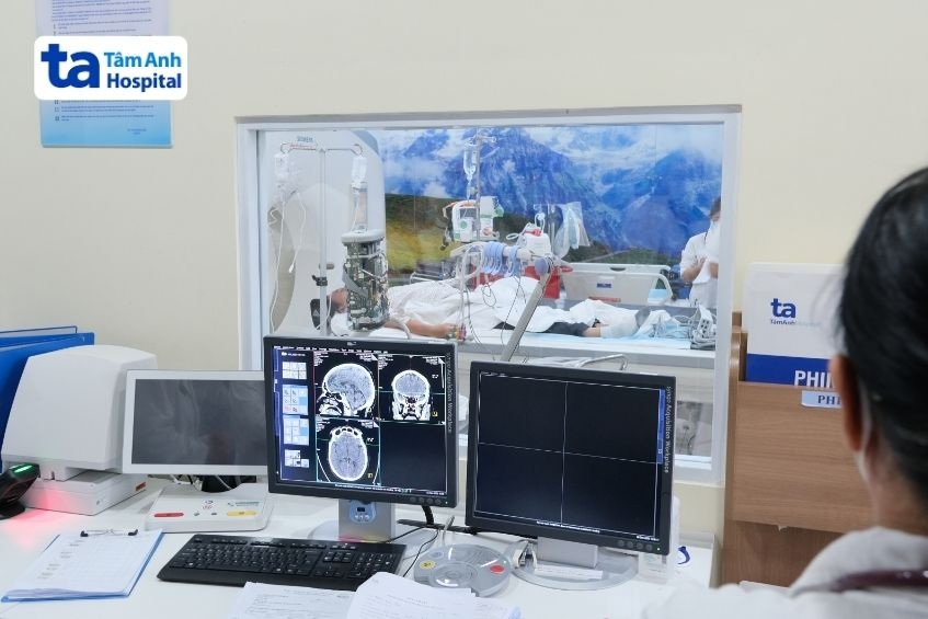 chụp ct cấp cứu đột quỵ não tại tâm anh
