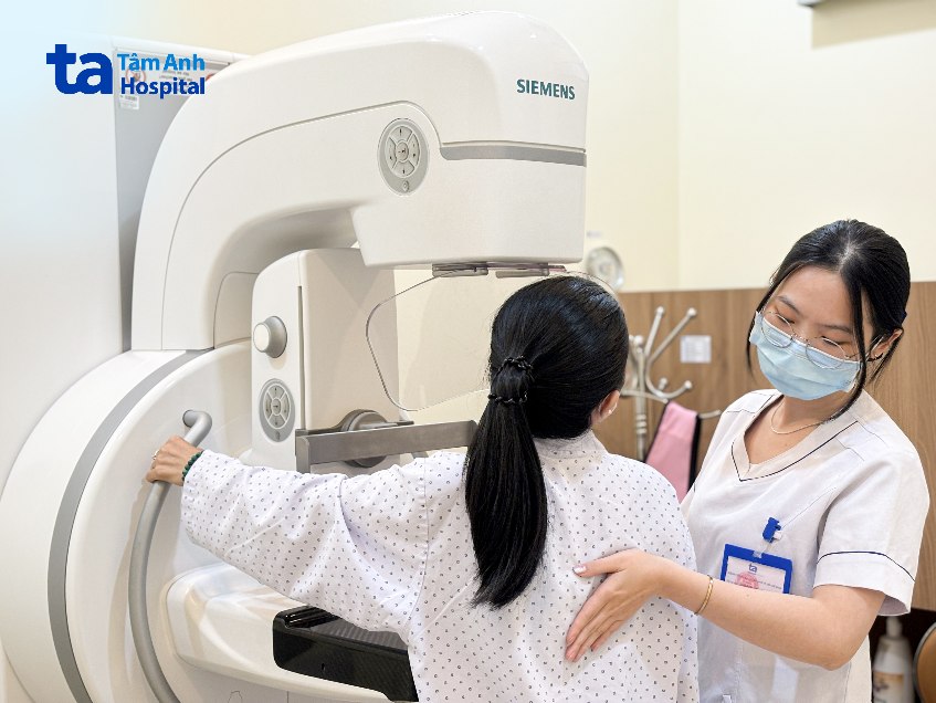 chụp X-quang tuyến vú