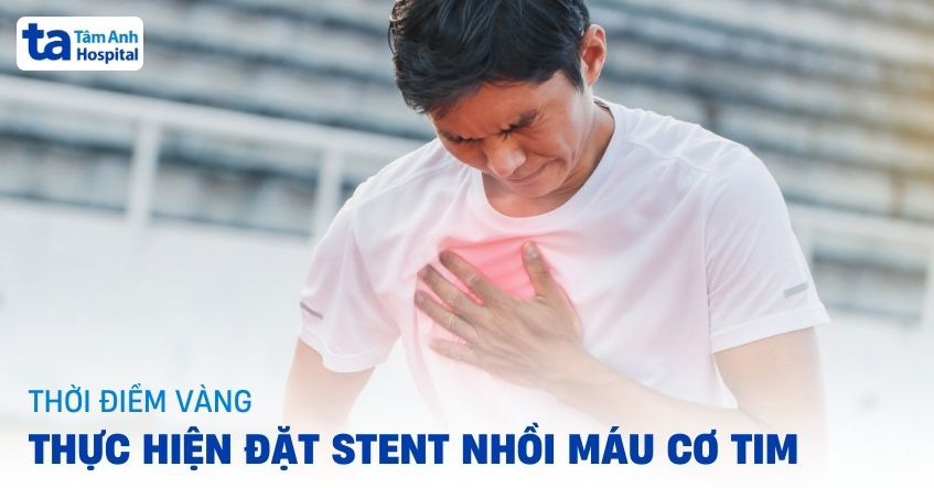 Đặt stent nhồi máu cơ tim: Thời điểm vàng thực hiện và quy trình [A-Z]
