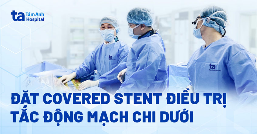 Đau chân tưởng bệnh xương khớp hóa tắc động mạch chi dưới
