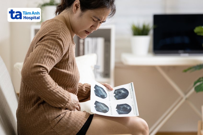 dấu hiệu u mô đệm đường tiêu hóa