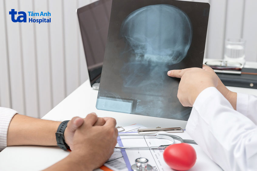 đến bệnh viện để chẩn đoán ung thư đầu mặt cổ