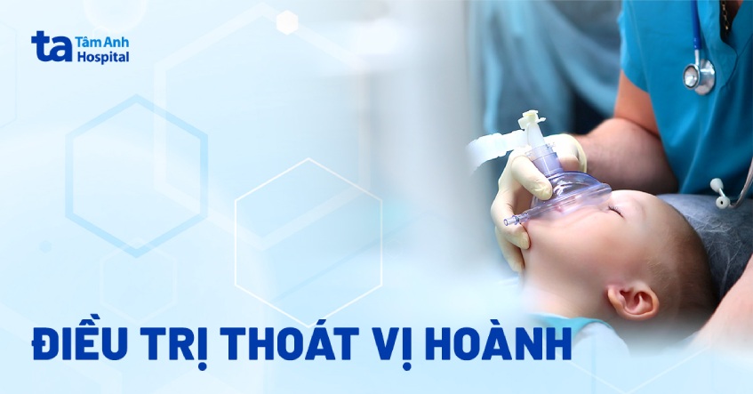 điều trị thoát vị hoành
