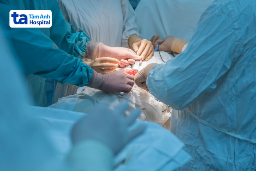điều trị u mô đệm đường tiêu hóa