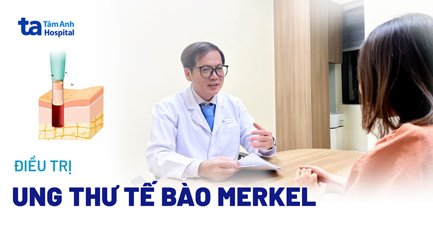Điều trị ung thư da tế bào Merkel như thế nào? 4 phương pháp hiệu quả