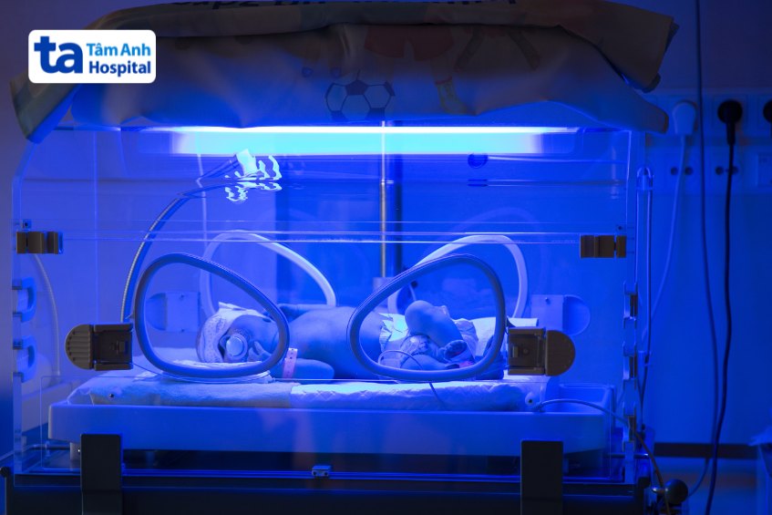Điều trị vàng da cho trẻ sơ sinh bằng phương pháp chiếu đèn