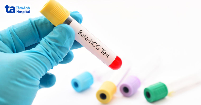 Đo định lượng beta HCG nhằm chẩn đoán có thai sớm ở phụ nữ