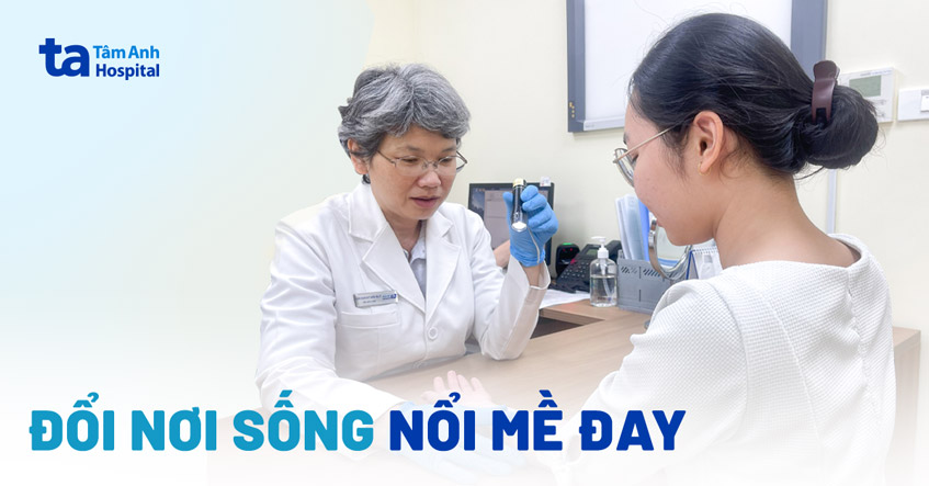 Đổi nơi sống, nổi mề đay