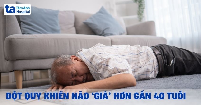 đột quỵ khiến não già hơn gần 40 tuổi