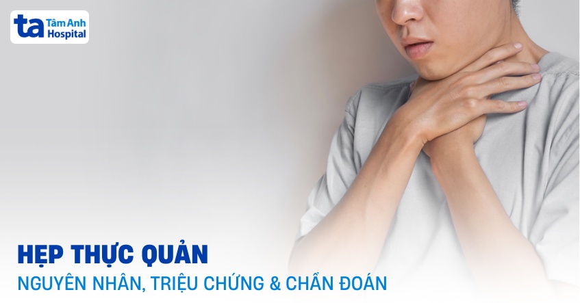 hẹp thực quản