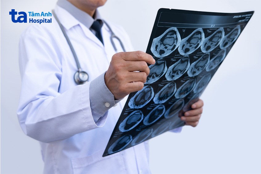 hình ảnh ct đầu gối