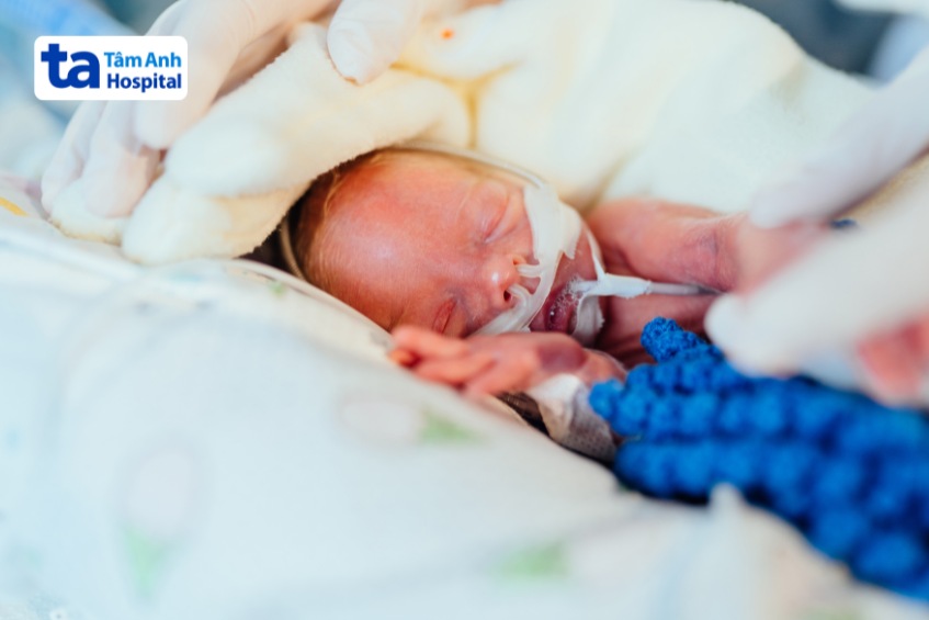 hình ảnh về em bé sinh cực non 26 tuần hình 1