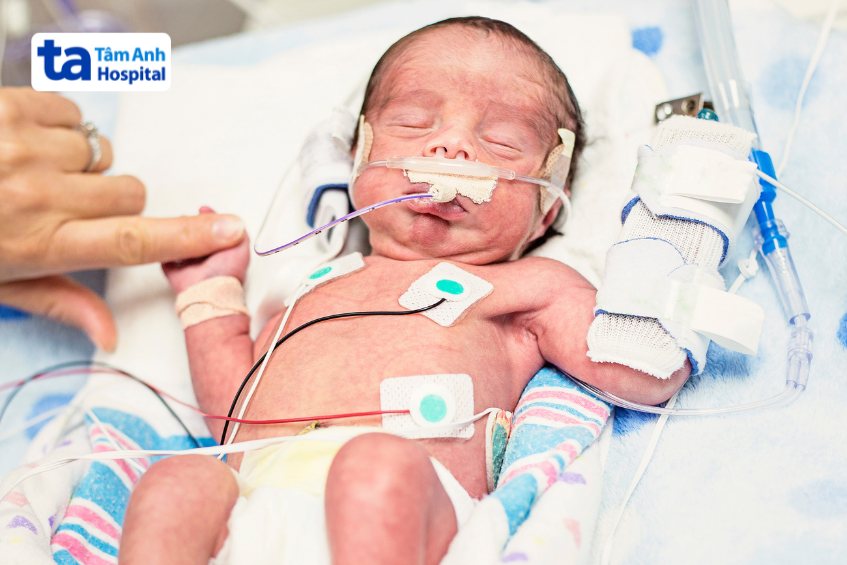 hình ảnh về em bé sinh cực non 26 tuần hình 2