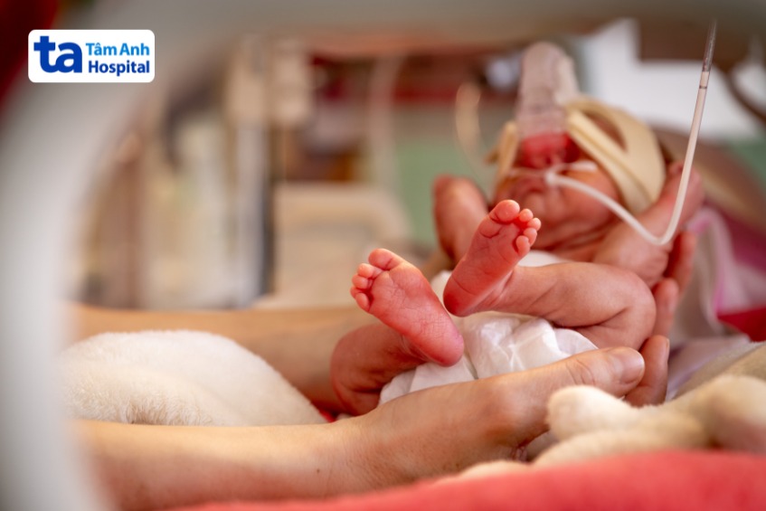 Hình ảnh về trẻ sinh cực non 25 tuần hinh 1