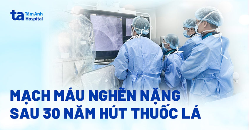 Hút thuốc lá 30 năm, mạch máu người đàn ông nghẽn nặng
