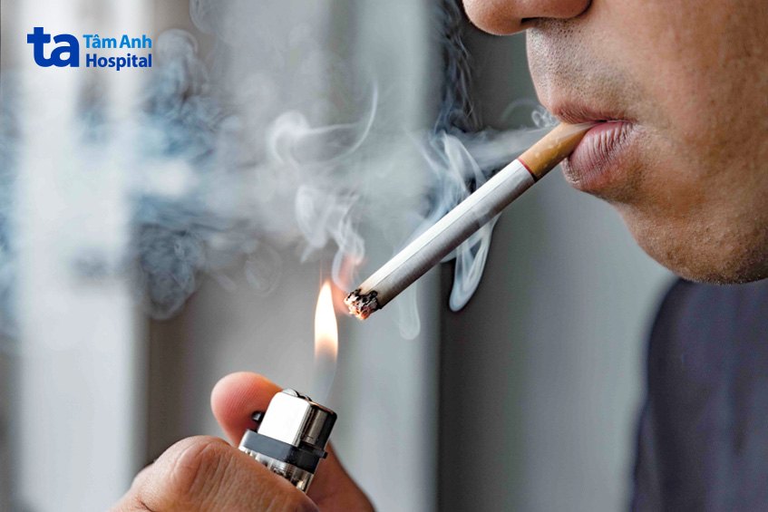 Hút thuốc lá là nguyên nhân hàng đầu gây ra bệnh COPD