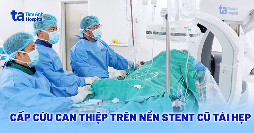 Khoan lòng mạch và đặt stent cứu bệnh nhân tái hẹp mạch vành nặng