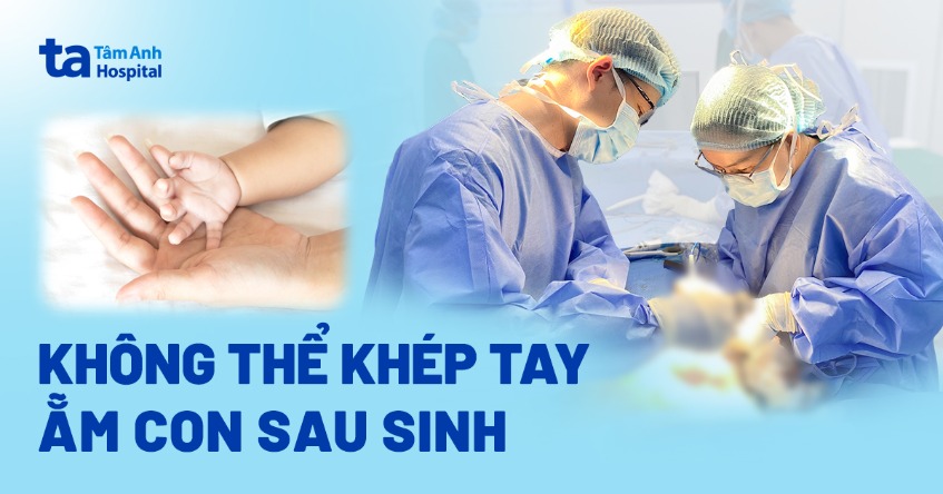 Không thể khép tay, ẵm con sau sinh