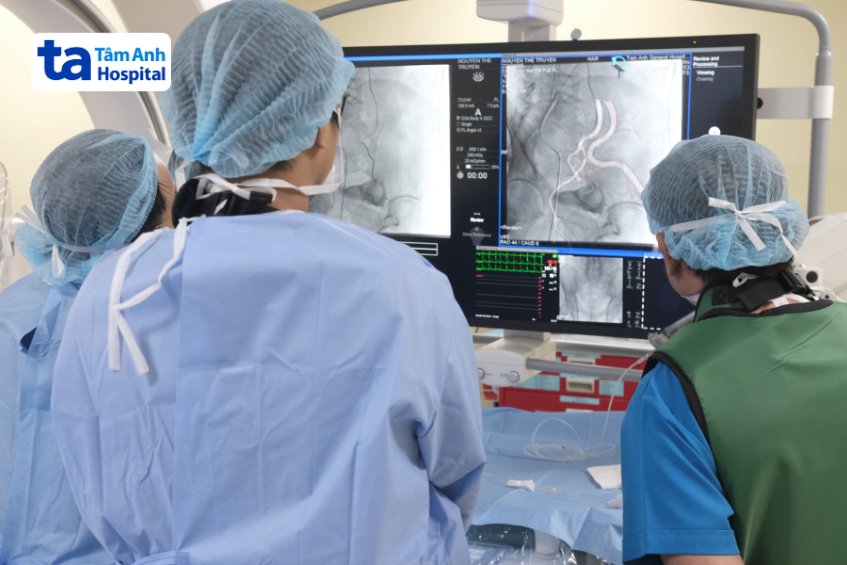 kỹ thuật chụp dsa