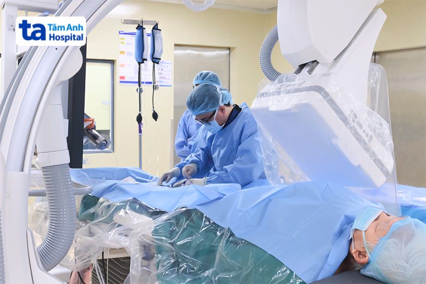 DSA hỗ trợ điều trị tim mạch